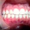 dra-kenny-perero-pin-tratamiento-ortodoncia-02.jpg