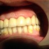 dra-kenny-perero-pin-rehabilitacion-dental-05.jpg