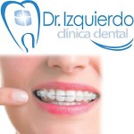 dr-felix-izquierdo-clinica-dental-en-merida