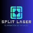 split-laser